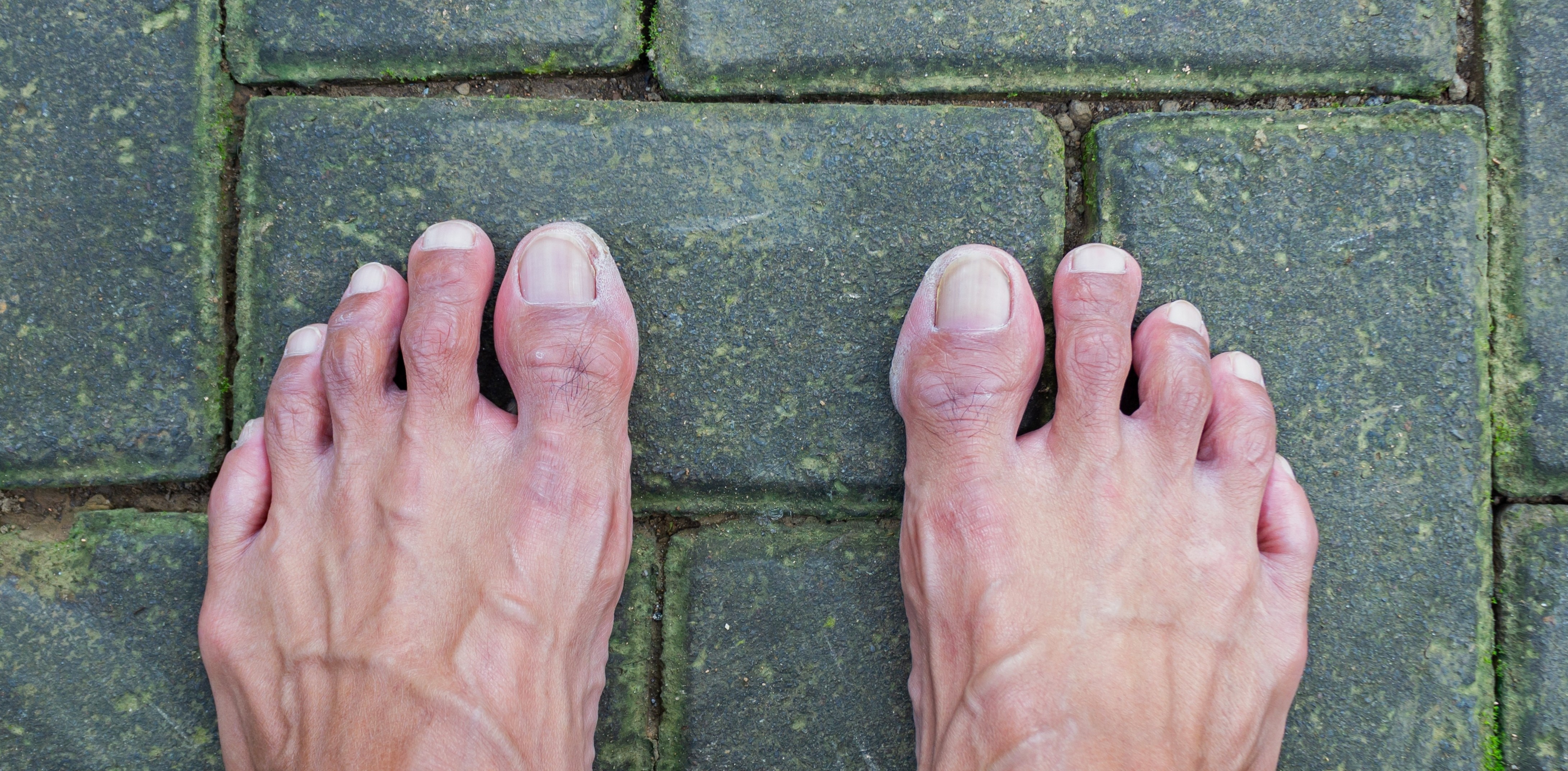 Barefoot or Shoes? The Debate for Kids and Athletes