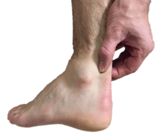 pain in back of heel and ankle